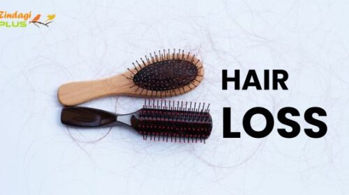 Hair Loss, hair loss treatment, hair loss causes, hair loss treatment for men | women, hair loss stages, hair loss symptoms, hair loss medicine, hair loss vitamins